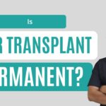 Is a Hair Transplant Permanent?