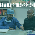 Can I Get A Hair Transplant At 25?